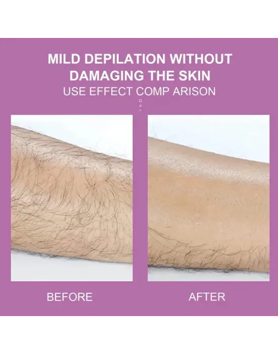 Epilatör Kristal Epilasyon Aleti