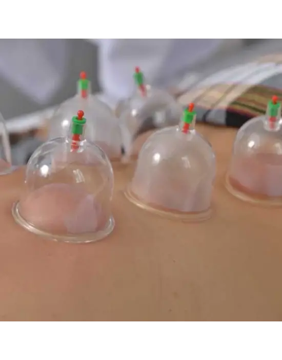 Kupa Çekme Hacamat Seti 6 Adet