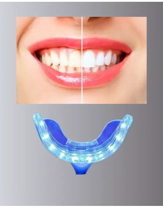 Mavi Işık Teknolojisi İle Güvenli Diş Beyazlatıcı Sistem