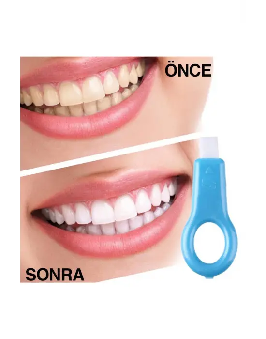 Omarı Ağız Bakımı Jel Diş Beyazlatıcı