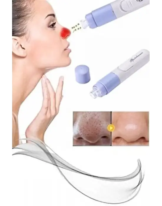 Pore Cleaner Vakumlu Yüz Temizleme Siyah Nokta Temizleme Cihazı