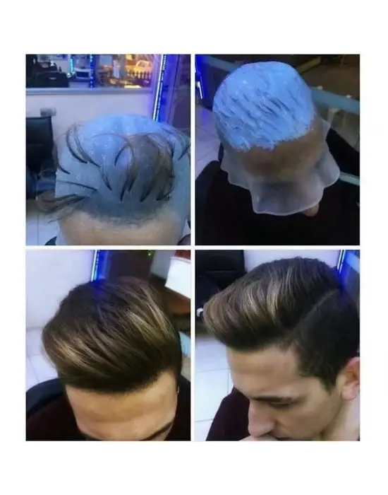 Profesyonel Silikon Delikli Röfle Bonesi