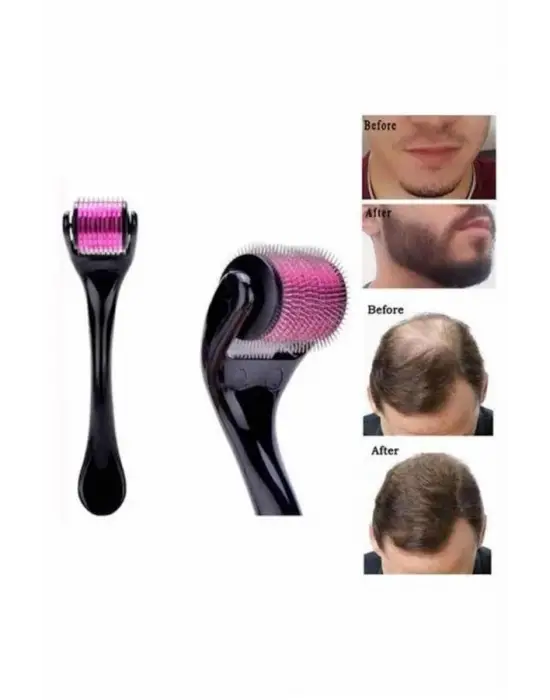 Saç Çıkarma Tarağı Dermaroller 540 Iğneli Roller 1 Mm Iğne Cilt Yüz Yenileme Bakım Seti