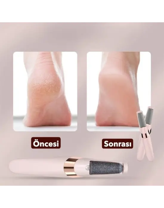 Şarjlı Ayak Törpüsü - Pedikür Ve Ayak Bakım Aleti