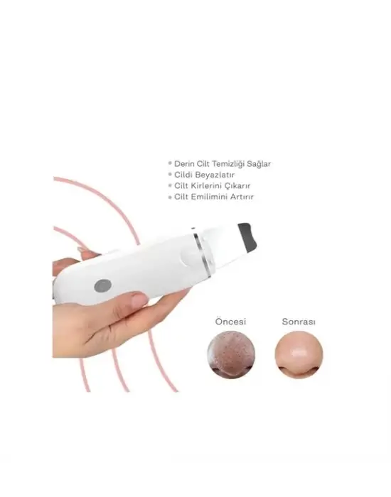 Ultrasonik Spatula Yüz Akne Giderici Siyah Nokta Temizleme Cihazı