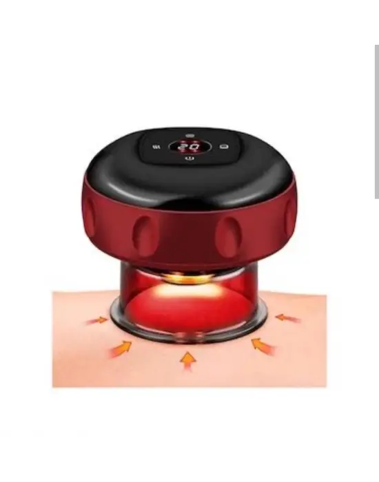 Vakumlu Hacamat Kupası, Şarjlı Kupa Çekme Hacamat Led Işıklı Masaj Ve Selülit Kupası