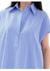 Omarı Şık Mavi Beyaz Çizgili Elbise