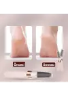 Şarjlı Ayak Törpüsü - Pedikür Ve Ayak Bakım Aleti
