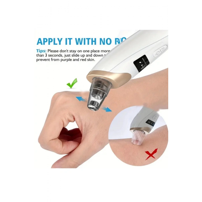 Auhma AHB-01 Vakumlu Siyah Nokta Temizleyici | 3 Kademeli Güç, Cilt Gözenek Temizleme Cihazı