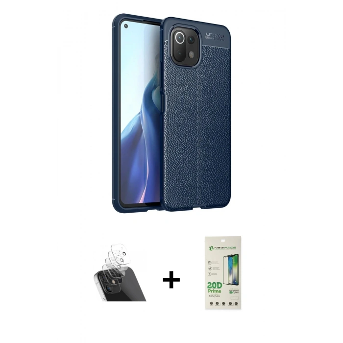MARSİLYAN™- Mİ 11 Lite Kılıf Doruk Klasik Özel Seri - Siyah 20D Premium Cam Ekran Koruyucu + Kamera Lens Koruma Cam - SF