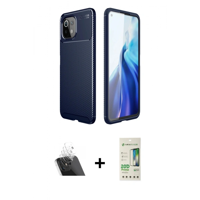 MARSİLYAN™- Mİ 11 Lite Kılıf Eksen Form Prime - Siyah 20D Premium Cam Ekran Koruyucu + Kamera Lens Koruma Cam - SF