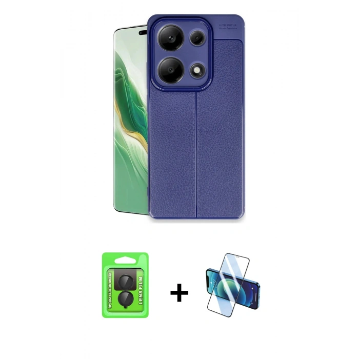 MARSİLYAN™- Redmi Note 13 Pro 4G Kılıf Doruk Klasik Özel Seri - Siyah 3D Antistatik Seramik Nano Ekran Koruyucu + Raze Metal Kamera Lens - SH