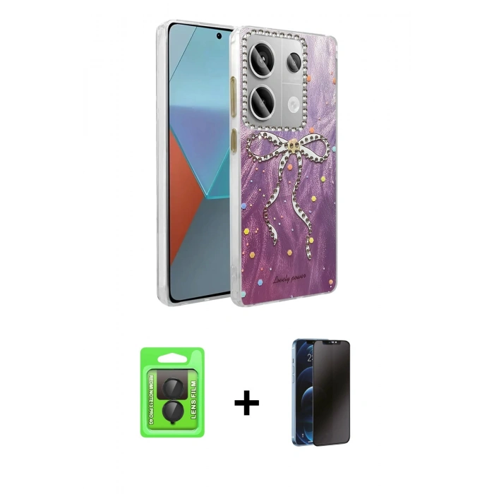 MARSİLYAN™- Redmi Note 13 Pro 4G Kılıf Zirve Modern Prime - Siyah 3D Antistatik Hayalet Cam Ekran Koruyucu + Raze Metal Kamera Lens - SH