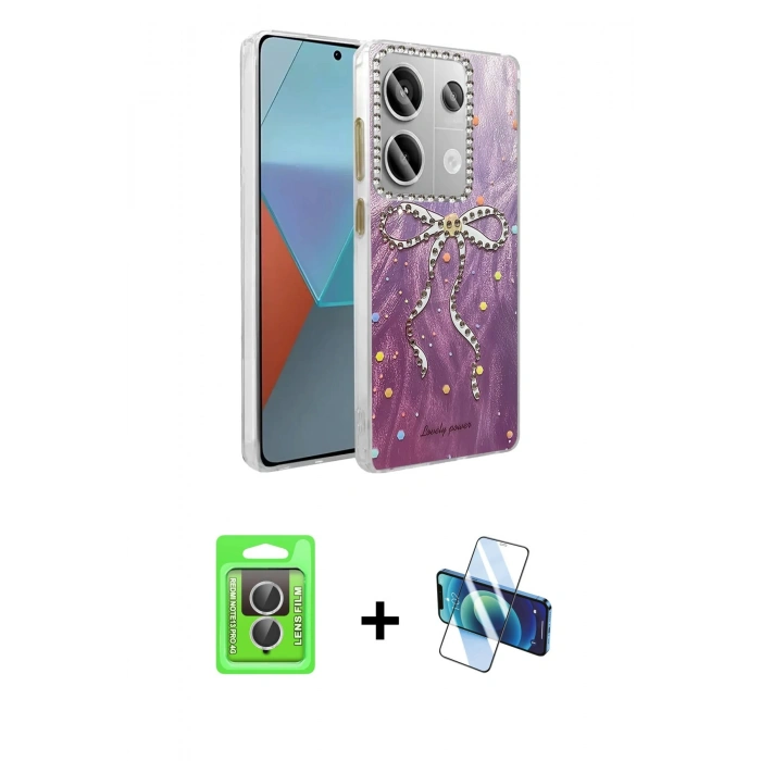 MARSİLYAN™- Redmi Note 13 Pro 4G Kılıf Zirve Modern Prime - Siyah 3D Antistatik Seramik Nano Ekran Koruyucu + Raze Metal Kamera Lens - GS