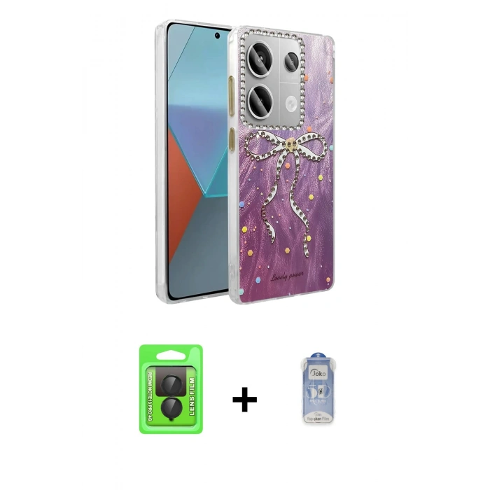 MARSİLYAN™- Redmi Note 13 Pro 4G Kılıf Zirve Modern Prime - Siyah Joko Magic 5D Cam + Raze Metal Kamera Lens - SH