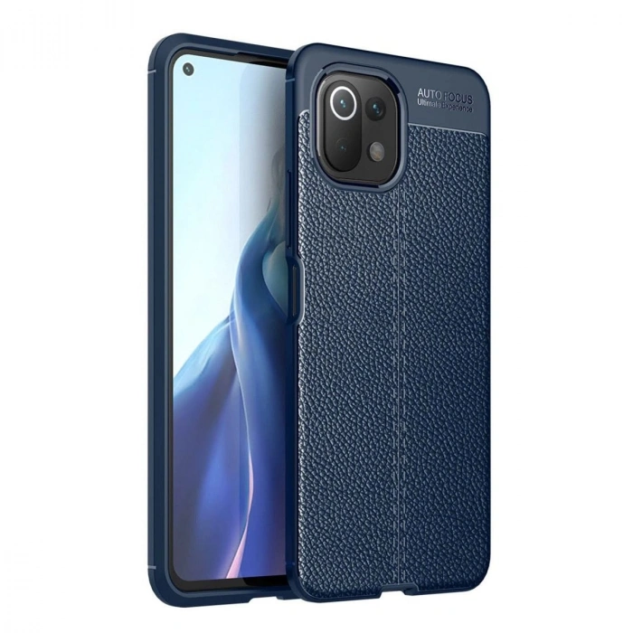 MARSİLYAN™- Xiaomi Mi 11 Lite Kılıf Auto Focus Kapak - Lacivert