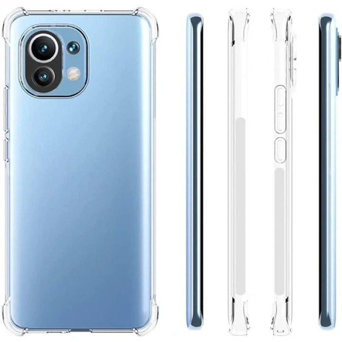 Xiaomi Mi 11 Lite Kamera Korumalı Shockproof Şeffaf Silikon Kılıf