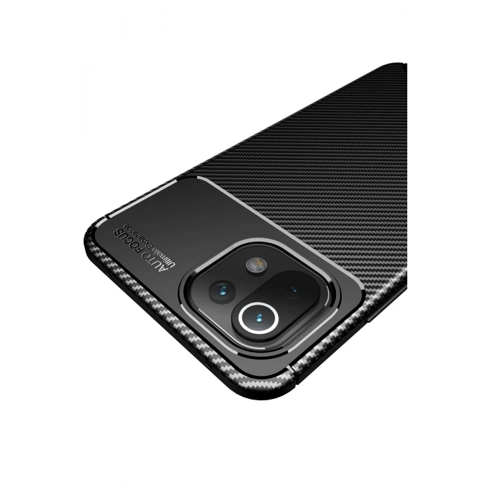 Xiaomi Mİ 11 Lite Kılıf Auto Focus Karbon Kapak - Siyah