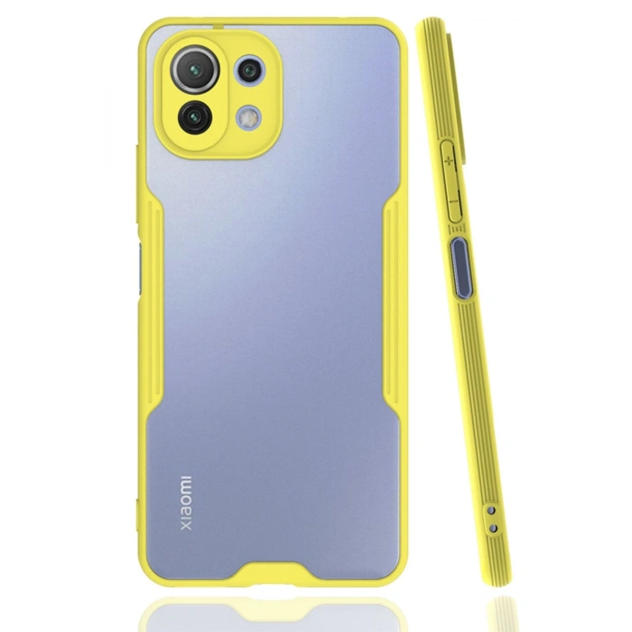 Xiaomi Mİ 11 Lite Kılıf Platin Silikon - Sarı