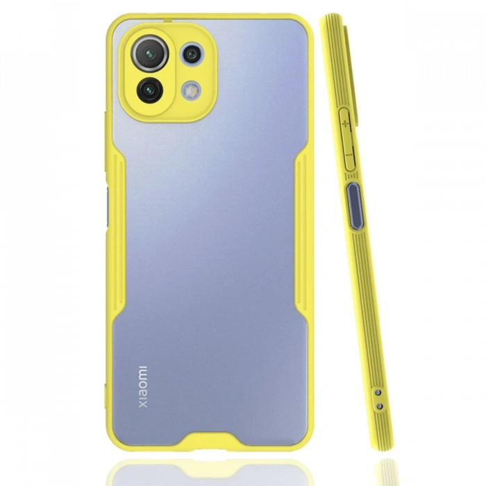 Xiaomi Mİ 11 Lite Kılıf Platin Silikon - Sarı