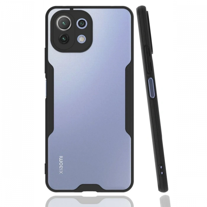 Xiaomi Mİ 11 Lite Kılıf Platin Silikon - Siyah