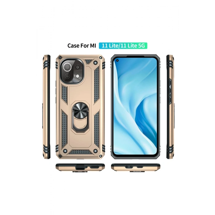 Xiaomi Mİ 11 Lite Kılıf Sofya Yüzüklü Silikon Kapak - Gold