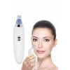 4 Başlıklı Pilli Vakumlu Siyah Nokta Temizleyici Akne Ve Sivilce Önleyici