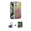 MARSİLYAN™- iPhone 16 Kılıf Zirve Modern Prime - Şeffaf 360 Full Body Arka Koruyucu + Bilvis Titan Kamera Lens - SH