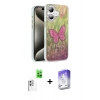 MARSİLYAN™- iPhone 16 Kılıf Zirve Modern Prime - Siyah Bilvis 5in1 3D Magic Cam Ekran Koruyucu + Beyaz Raze Metal Kamera Lens