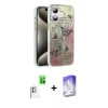 MARSİLYAN™- iPhone 16 Kılıf Zirve Modern Prime - Siyah Bilvis 5in1 3D Magic Cam Ekran Koruyucu + Beyaz Raze Metal Kamera Lens
