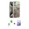 MARSİLYAN™- iPhone 16 Kılıf Zirve Modern Prime - Siyah Bilvis 5in1 5D Magic Hayalet Cam Ekran Koruyucu + Raze Metal Kamera Lens - BZ