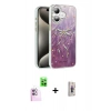 MARSİLYAN™- iPhone 16 Plus Kılıf Zirve Modern Prime - Siyah Bilvis 3D Cam Ekran Koruyucu + Raze Metal Kamera Lens - PE