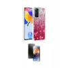 MARSİLYAN™- Redmi Note 12 Pro 4G Kılıf Zirve Modern Prime - Siyah 3D Antistatik Mat Seramik Nano Ekran Koruyucu