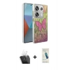 MARSİLYAN™- Redmi Note 13 Pro 4G Kılıf Zirve Modern Prime - Şeffaf Pasifik Cam Ekran Koruyucu + Kamera Lens Koruma Cam - SF