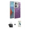 MARSİLYAN™- Redmi Note 13 Pro 4G Kılıf Zirve Modern Prime - Şeffaf Pasifik Cam Ekran Koruyucu + Kamera Lens Koruma Cam - SF