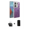 MARSİLYAN™- Redmi Note 13 Pro 4G Kılıf Zirve Modern Prime - Siyah 6D Antistatik Mat Seramik Hayalet Nano Ekran Koruyucu + Kamera Lens Koruma Cam - SF