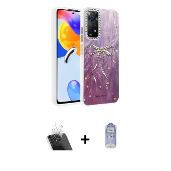 ieg™ Redmi Note 12 Pro 4G Kılıf Zirve Modern Prime - Siyah Joko Magic 5D Cam + Şeffaf Kamera Lens Koruma Cam