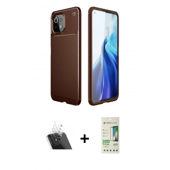 MARSİLYAN™- Mİ 11 Lite Kılıf Eksen Form Prime - Siyah 20D Premium Cam Ekran Koruyucu + Kamera Lens Koruma Cam - SF