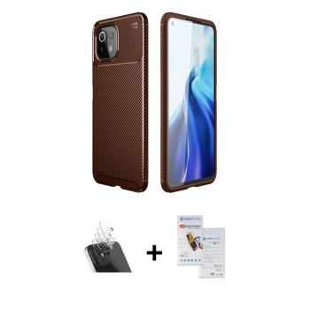 MARSİLYAN™- Mİ 11 Lite Kılıf Eksen Form Prime - Siyah Seramik Nano Ekran Koruyucu + Kamera Lens Koruma Cam - SF