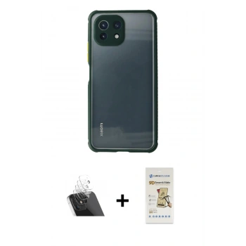 MARSİLYAN™- Mİ 11 Lite Kılıf Nova Asil Özel Seri - Siyah Mat Seramik Nano Ekran Koruyucu + Kamera Lens Koruma Cam - SF