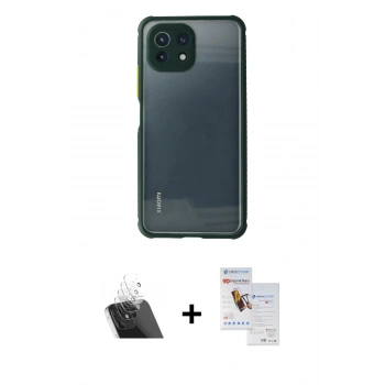 MARSİLYAN™- Mİ 11 Lite Kılıf Nova Asil Özel Seri - Siyah Seramik Nano Ekran Koruyucu + Kamera Lens Koruma Cam - SF