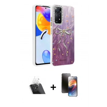 MARSİLYAN™- Redmi Note 12 Pro 4G Kılıf Zirve Modern Prime - Siyah 3D Antistatik Mat Seramik Nano Ekran Koruyucu + Kamera Lens Koruma Cam - SF