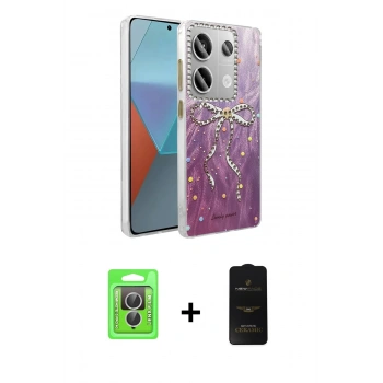 MARSİLYAN™- Redmi Note 13 Pro 4G Kılıf Zirve Modern Prime - Siyah 6D Antistatik Mat Seramik Hayalet Nano Ekran Koruyucu + Raze Metal Kamera Lens - GS