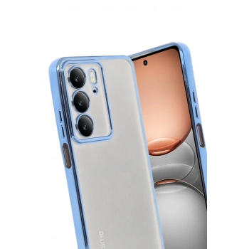 Realme C75 4G Kılıf Razer Lensli Silikon - Açık Mavi