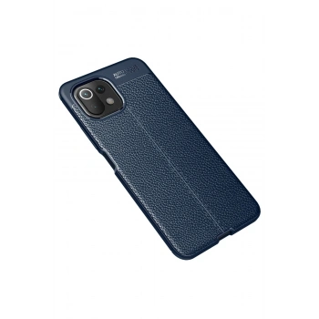 Xiaomi Mİ 11 Lite Kılıf Auto Focus Kapak - Lacivert