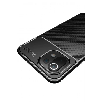 Xiaomi Mİ 11 Lite Kılıf Auto Focus Karbon Kapak - Siyah