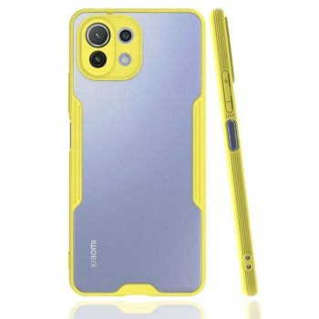 Xiaomi Mİ 11 Lite Kılıf Platin Silikon - Sarı