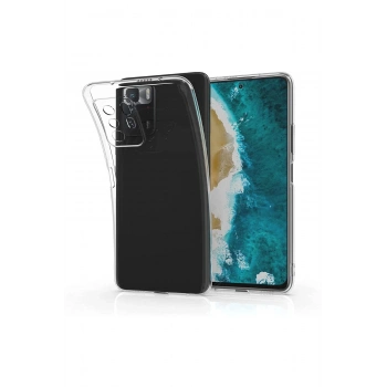 Xiaomi Poco X3 GT Kılıf Lüx Şeffaf Silikon