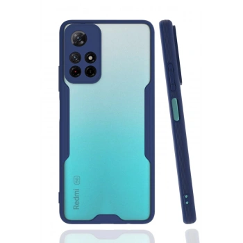 Xiaomi Redmi Note 11T Kılıf Platin Silikon - Lacivert