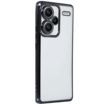 Xiaomi Redmi Note 13 Pro Plus Kılıf Razer Lensli Silikon - Siyah